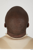  Photos Zeeshan Fowler bald head 0005.jpg